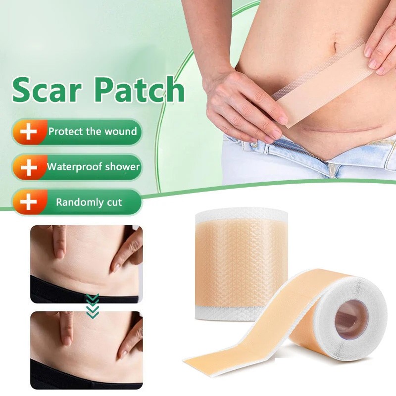 Silicone Scars Patch Keloid Bump Removal Sticker Strips Scar Reducing ...