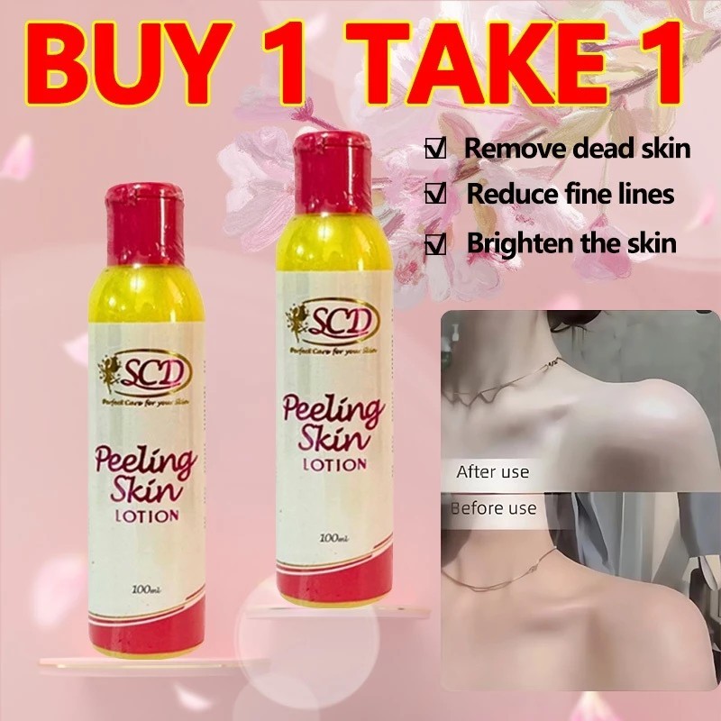 SCD Peeling Skin Lotion 100ml – Exfoliates and Renews for Smoother Skin ...