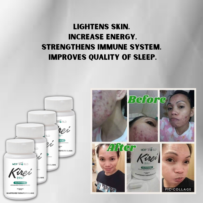 kirei glutathione review BUY 1 TAKE 1】YEOUBI Kirei Glutathione & Collagen | Hyaluronic Acid Grape  Seed & Rose Vitamin skin
