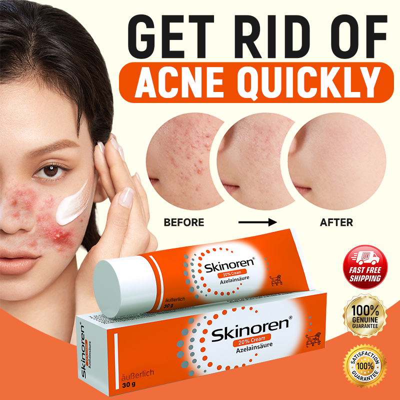 Photo inspiration: Picture Idea: Skinoren Acne Treatment Cream Acne Removal Cream Anti Acne Clear