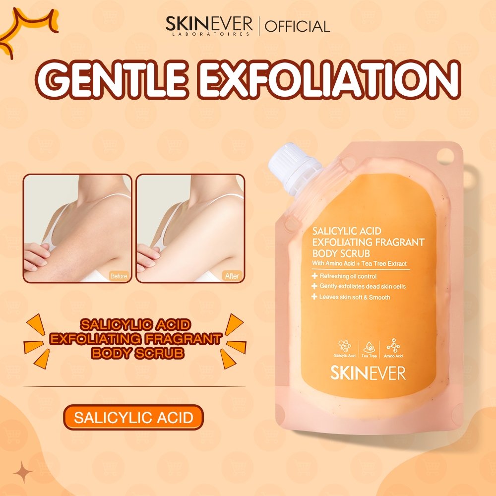 SKINEVER Official Store PH, Online Shop | Shopee Philippines