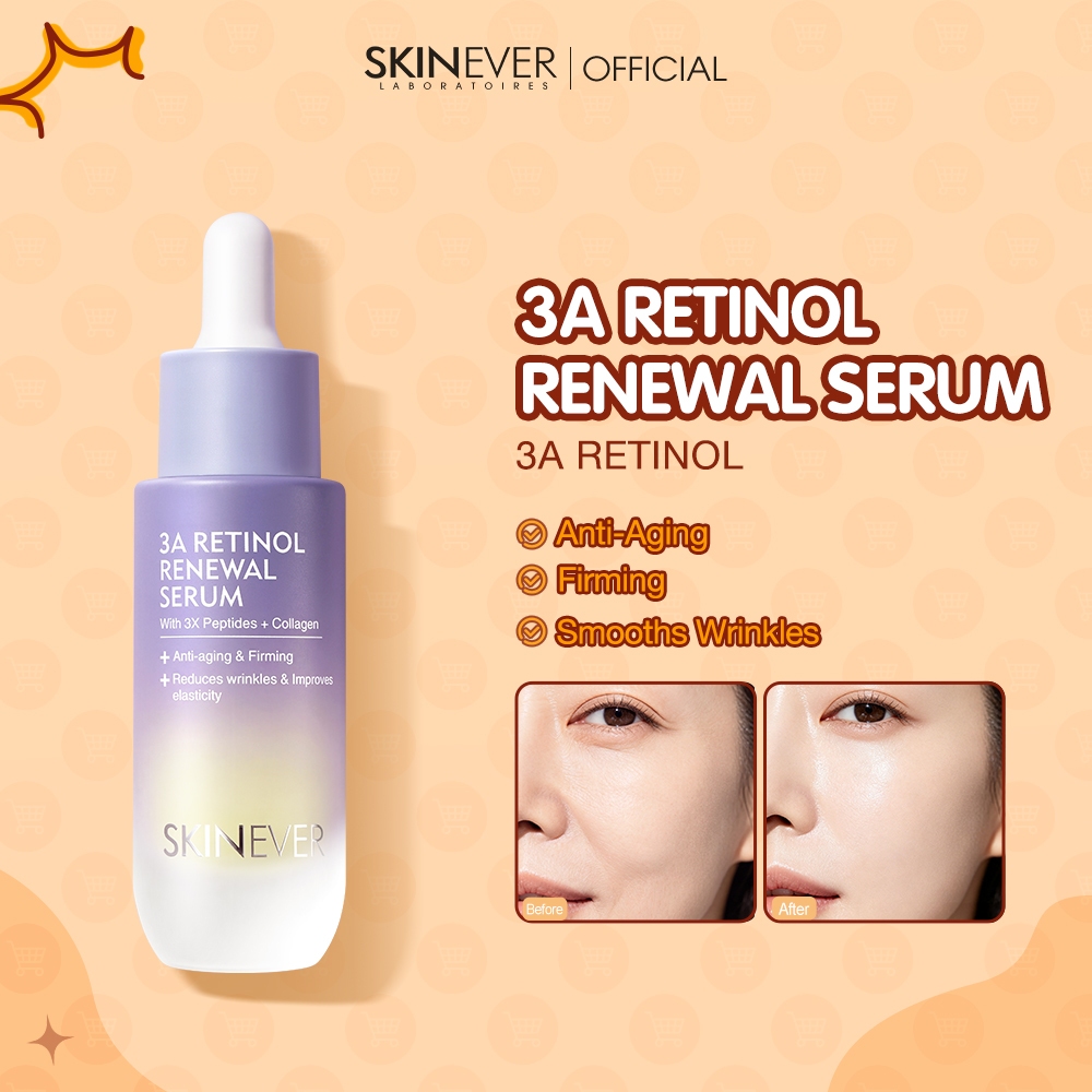 SKINEVER Official Store PH, Online Shop | Shopee Philippines