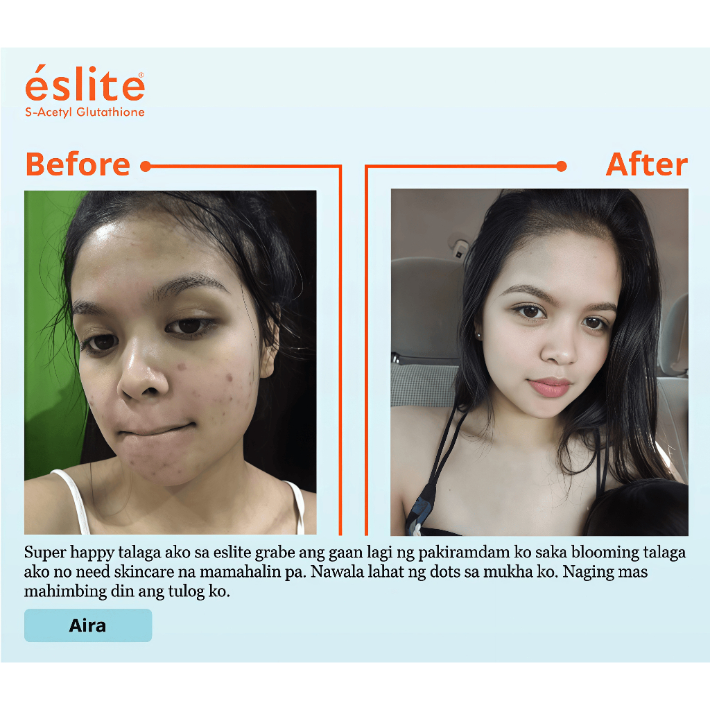 Eslite S-Acetyl Glutathione (Anti Aging and Skin Whitening Gluta Capsule) 60 Capsules