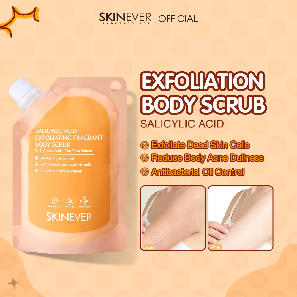 SKINEVER Official Store PH, Online Shop | Shopee Philippines