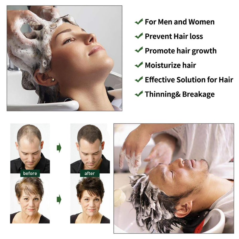 Rodil Ginger Hair Growth Shampoo For Dandruff And Itching Deep ...