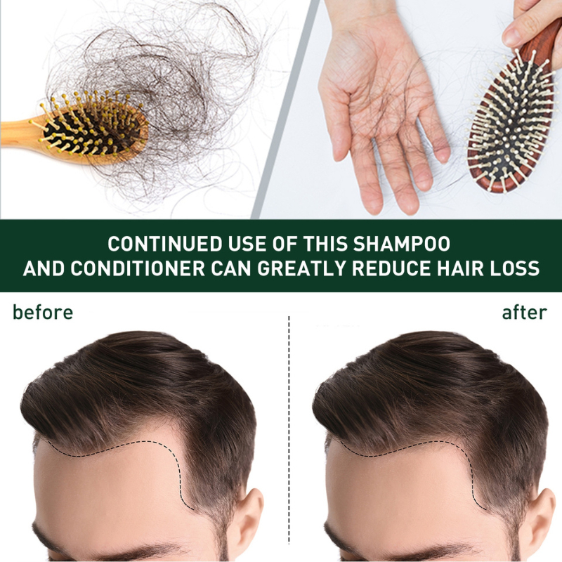 Rodil Ginger Hair Growth Shampoo For Dandruff And Itching Deep ...