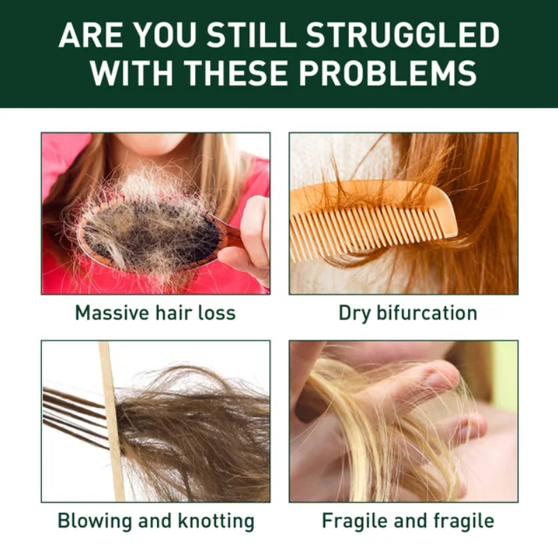 Rodil Ginger Hair Growth Shampoo For Dandruff And Itching Deep ...