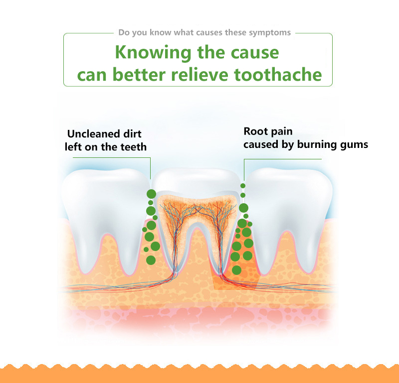 Toothache Spray Periodontitis Tooth Decay Pains Teeth Oral Pain ...