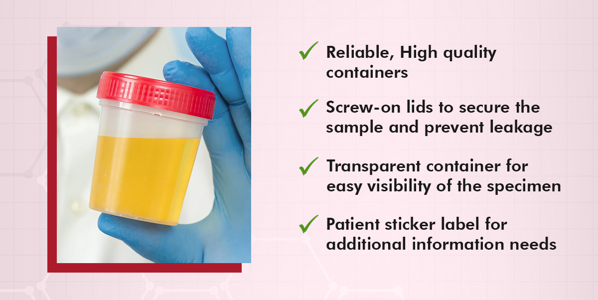 Sure-Guard Sterile Urine/Stool Container (60mL) | Transparent, Screw-on ...
