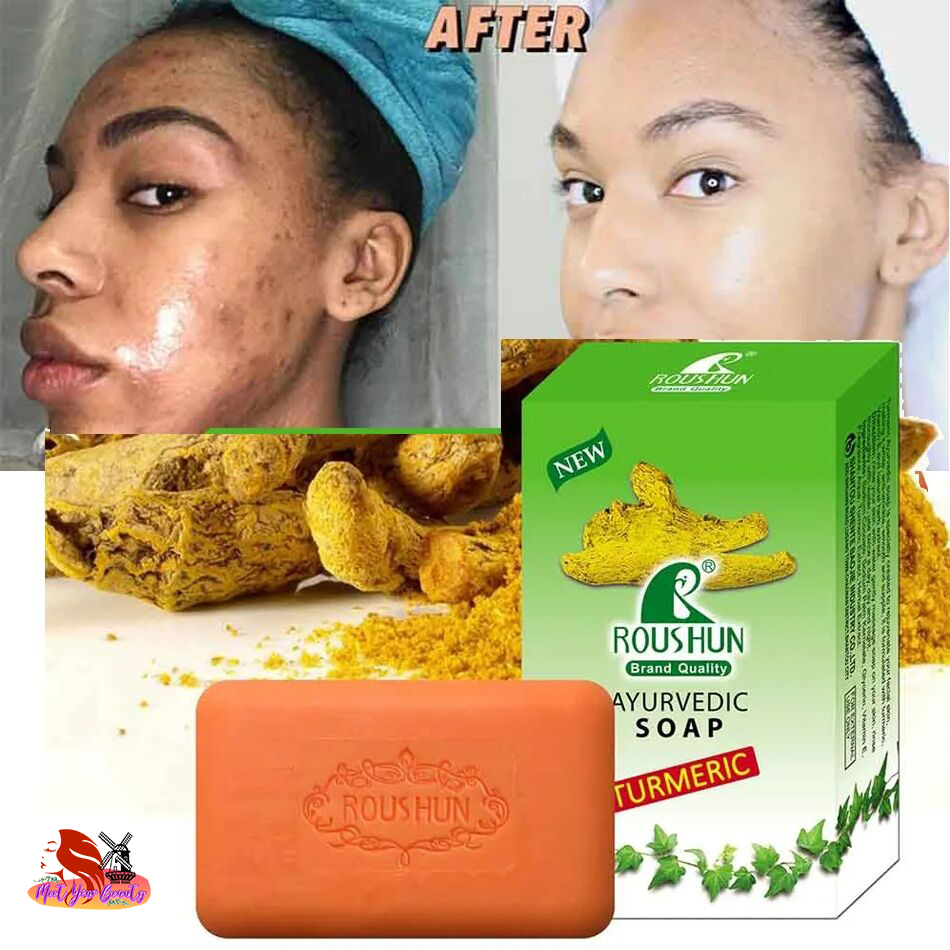 Original Turmeric Soap Deep Cleansing Whitening Moisturizing Acne