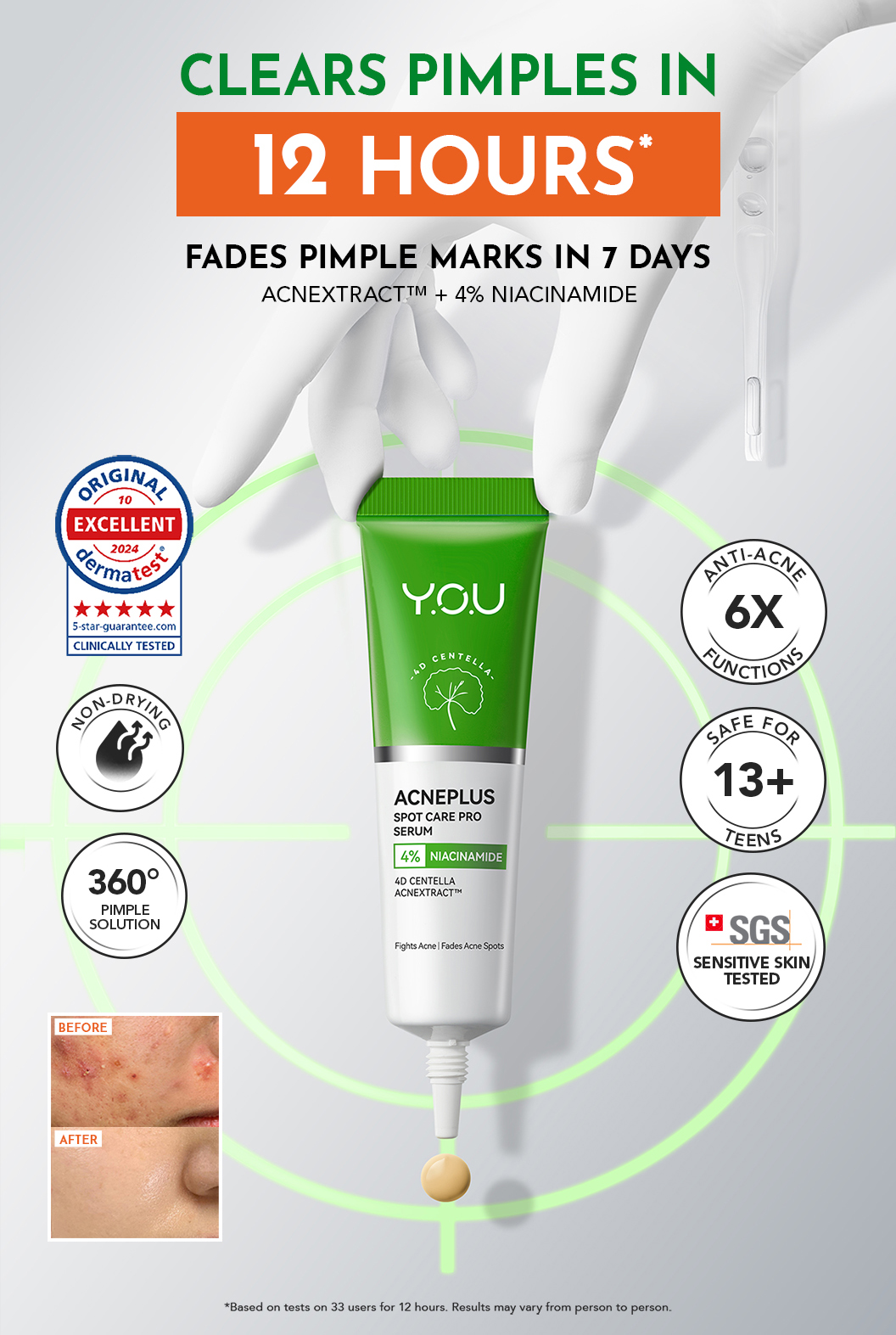 BEST SELLER | Y.O.U AcnePlus Spot Care Pro Serum 15g l Reduces ...