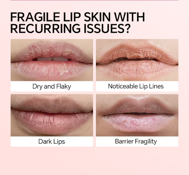 Vaseline Lip Gel Focus On Lip Repair Remove Dead Skin Lip Repair Care ...