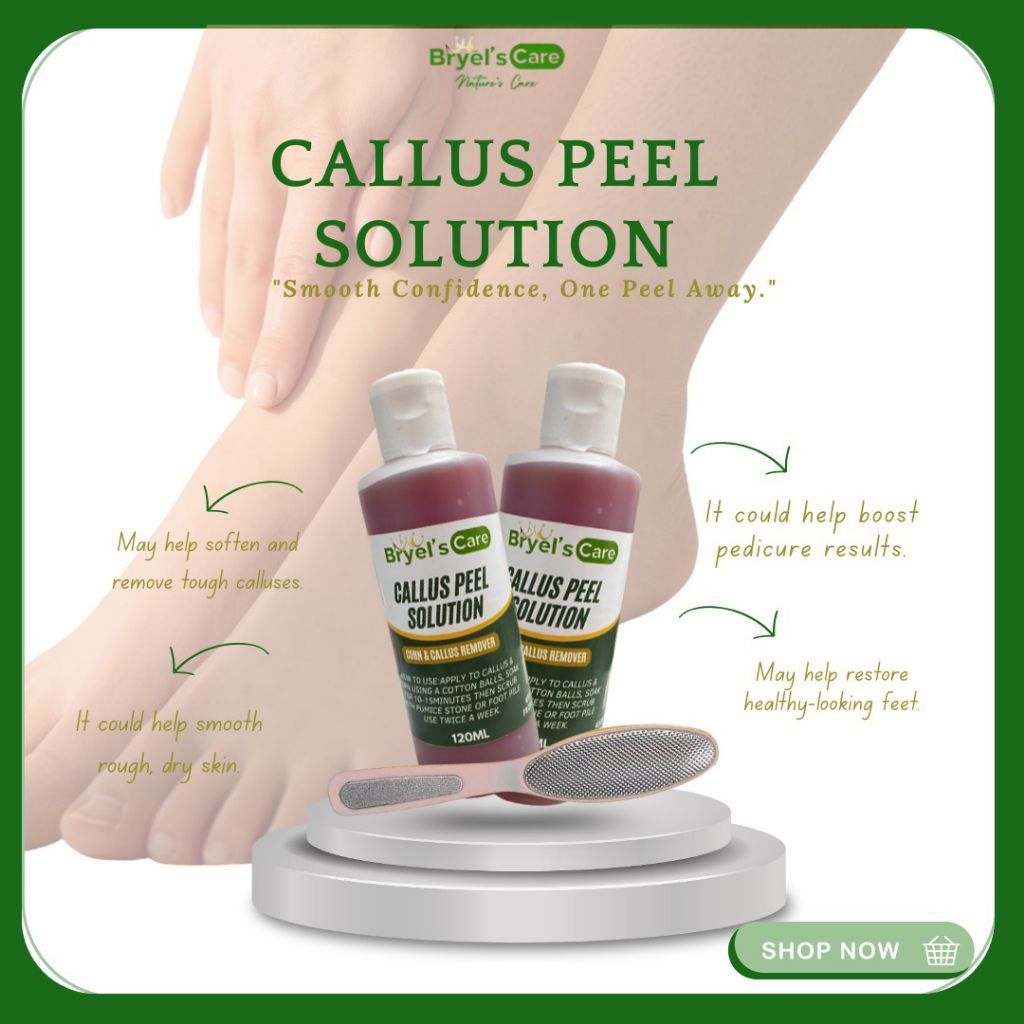 BRYELS CALLUS PEEL ROMOVER SET CALLUS SOLUTION PANTANGGAL KALYO WITH ...