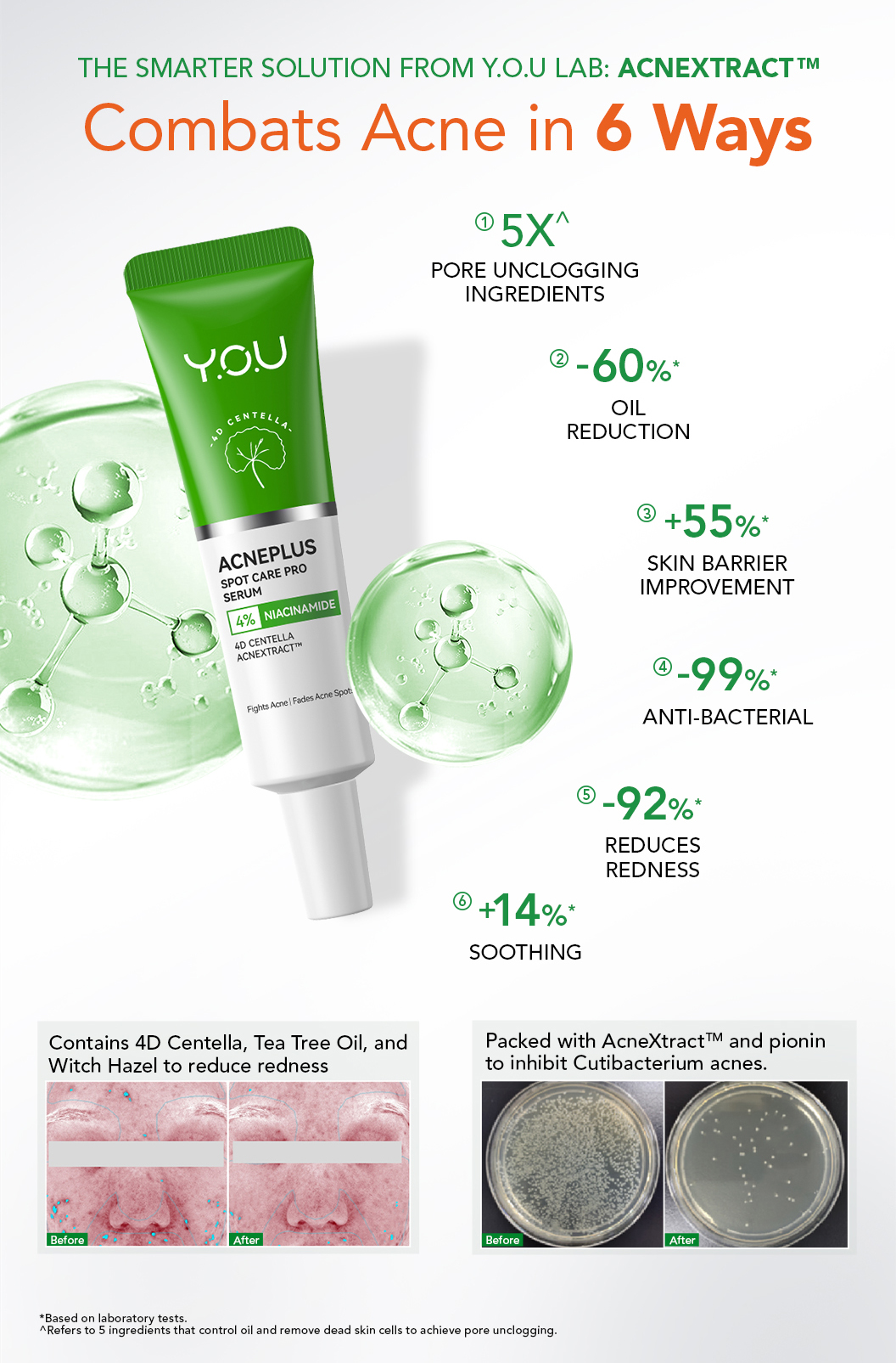 [NEW LAUNCH] Y.O.U AcnePlus Spot Care Pro Serum 15g l Reduces Breakouts ...
