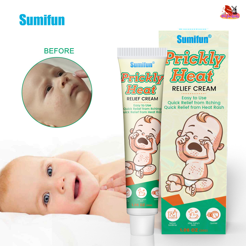 Anti-itch Cream Prickly Heat Gentle On Skin Herbal Cream For Sweat Rash ...