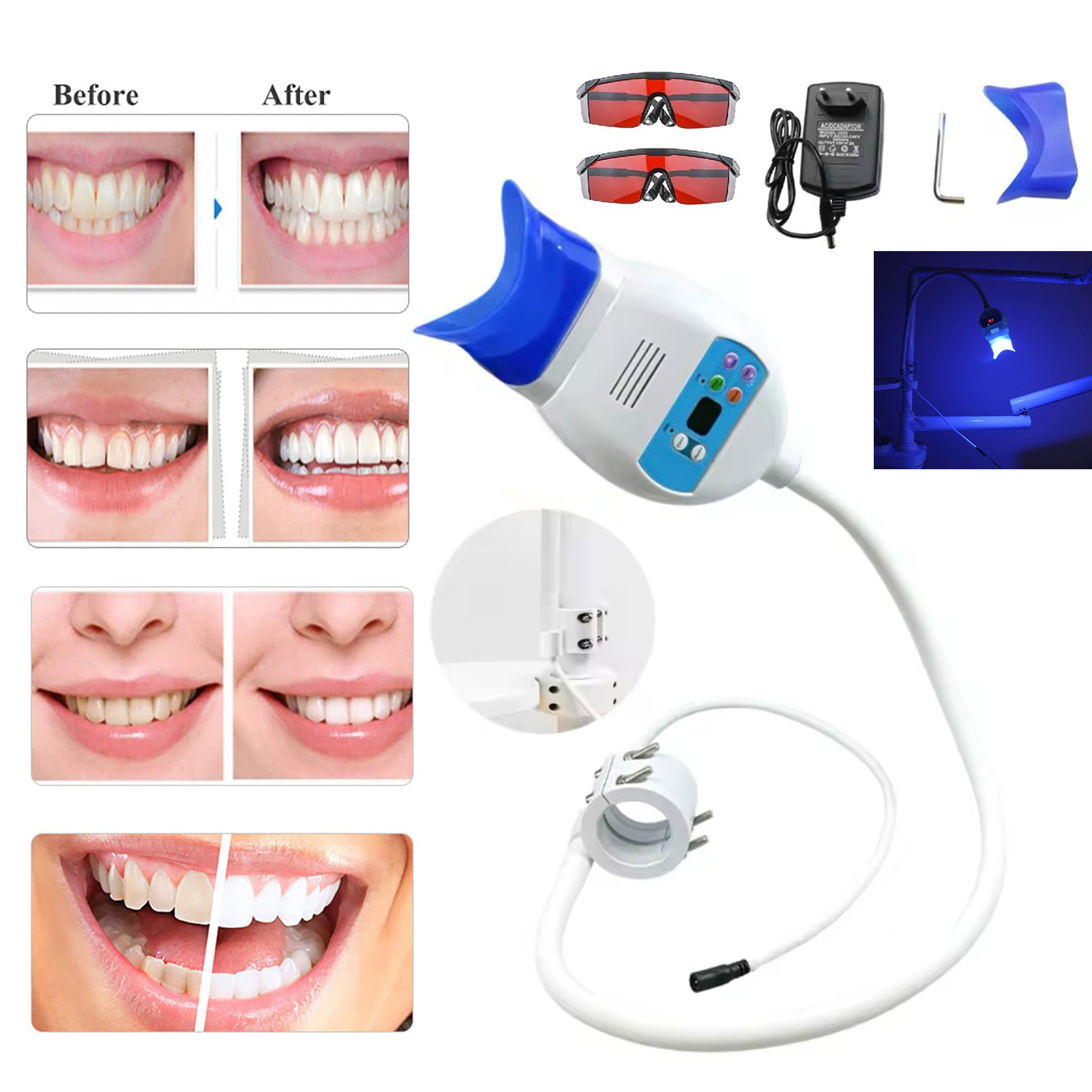 Dentist Professional Cold Light Bleaching LED Machine Tooth Bleaching ...
