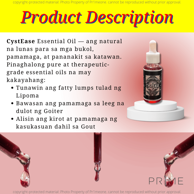Cystease l Cyst Ease Remove Cyst, Gout Lipoma & Goiter l Natural ...