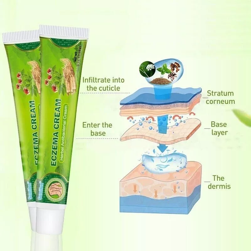 ORIGINAL SUMIFUN ECZEMA CREAM PSORIASIS DERMATITIS ITCHY SKIN AND ...