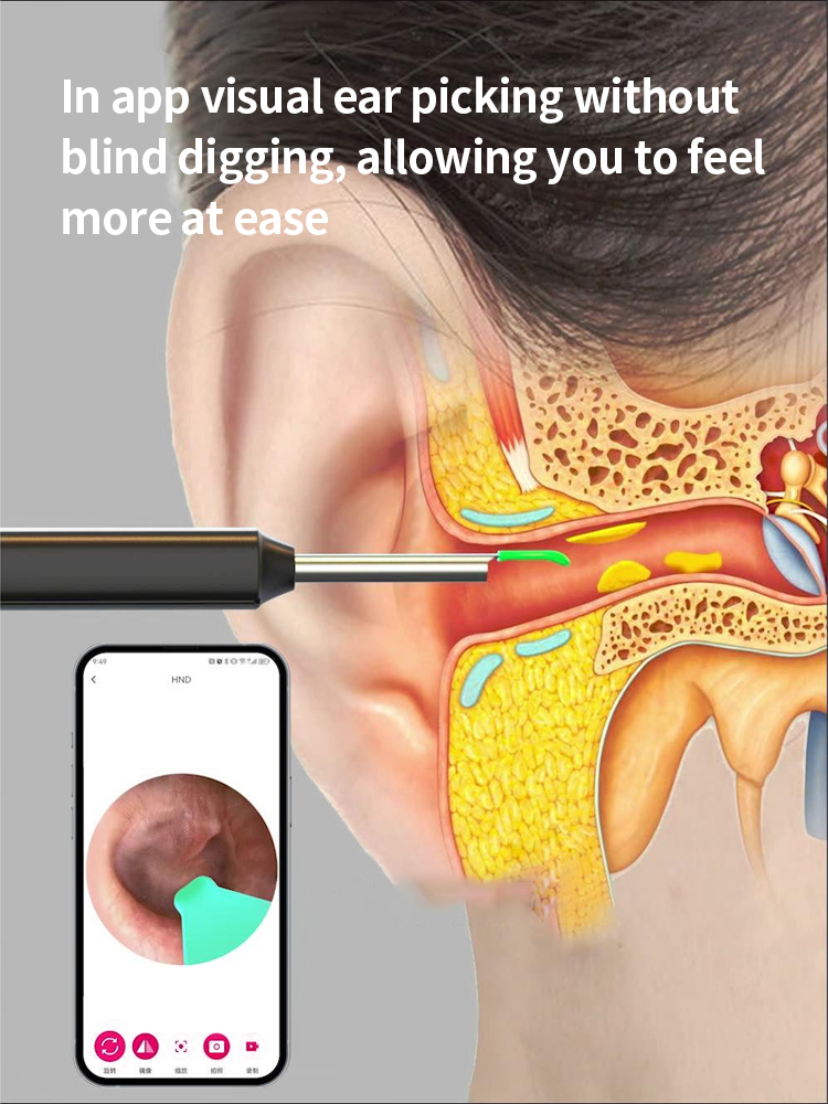 AIODIY Visual Ear Spoon Smart Ultra HD Endoscope Professional Lighted ...