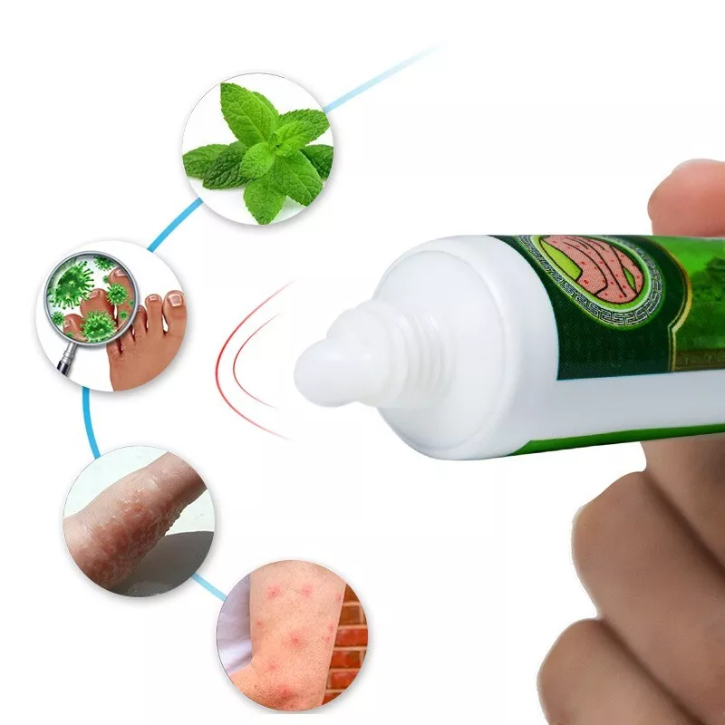 ORIGINAL SUMIFUN ECZEMA CREAM PSORIASIS DERMATITIS ITCHY SKIN AND ...