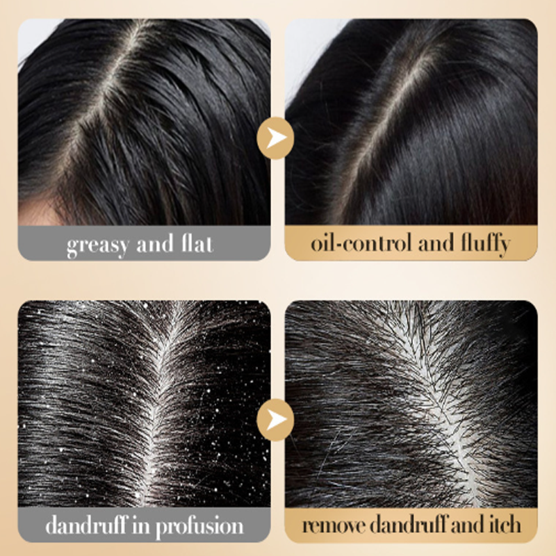 SADOER Collagen Anti-Dandruff Fluffy Shampoo BIOAOUA Rice Puree Shampoo ...