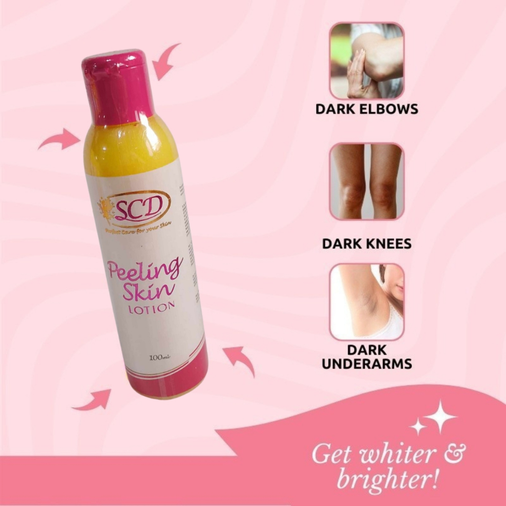 Buy 1 Take 2 SCD Peeling Skin Lotion for Dark Spots and Stretch Marks ...