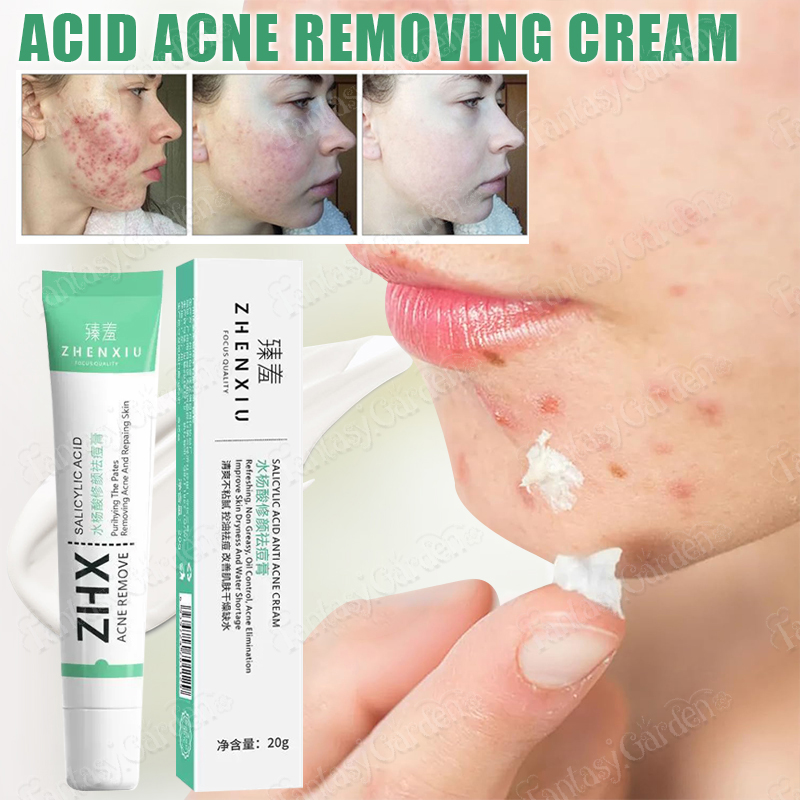 Salicylic Acid Acne Cream Remove Blackhead Oil Control Anti-Acne Repair ...