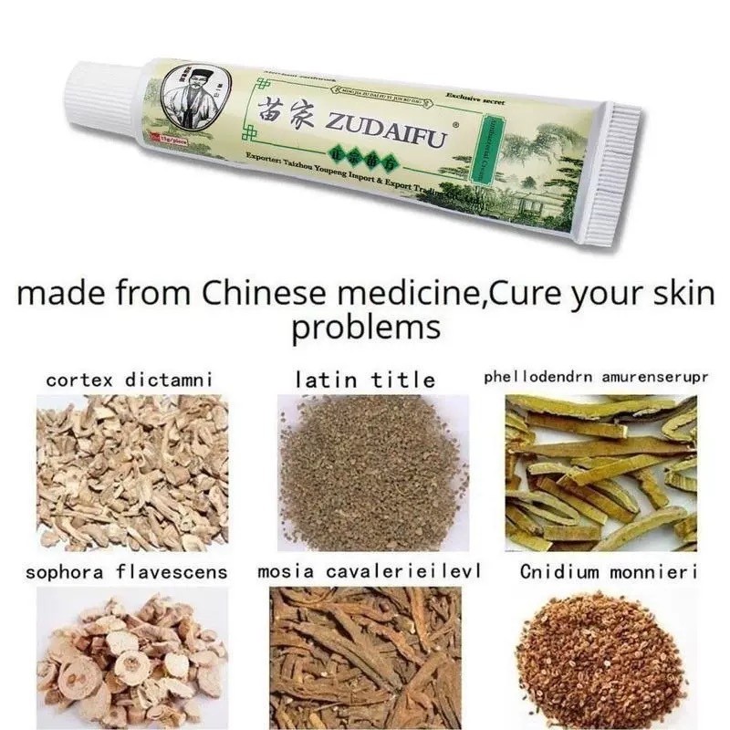 【B1T3】ZUDAIFU Original Chinese Herbal Skin Cream for Psoriasis ...