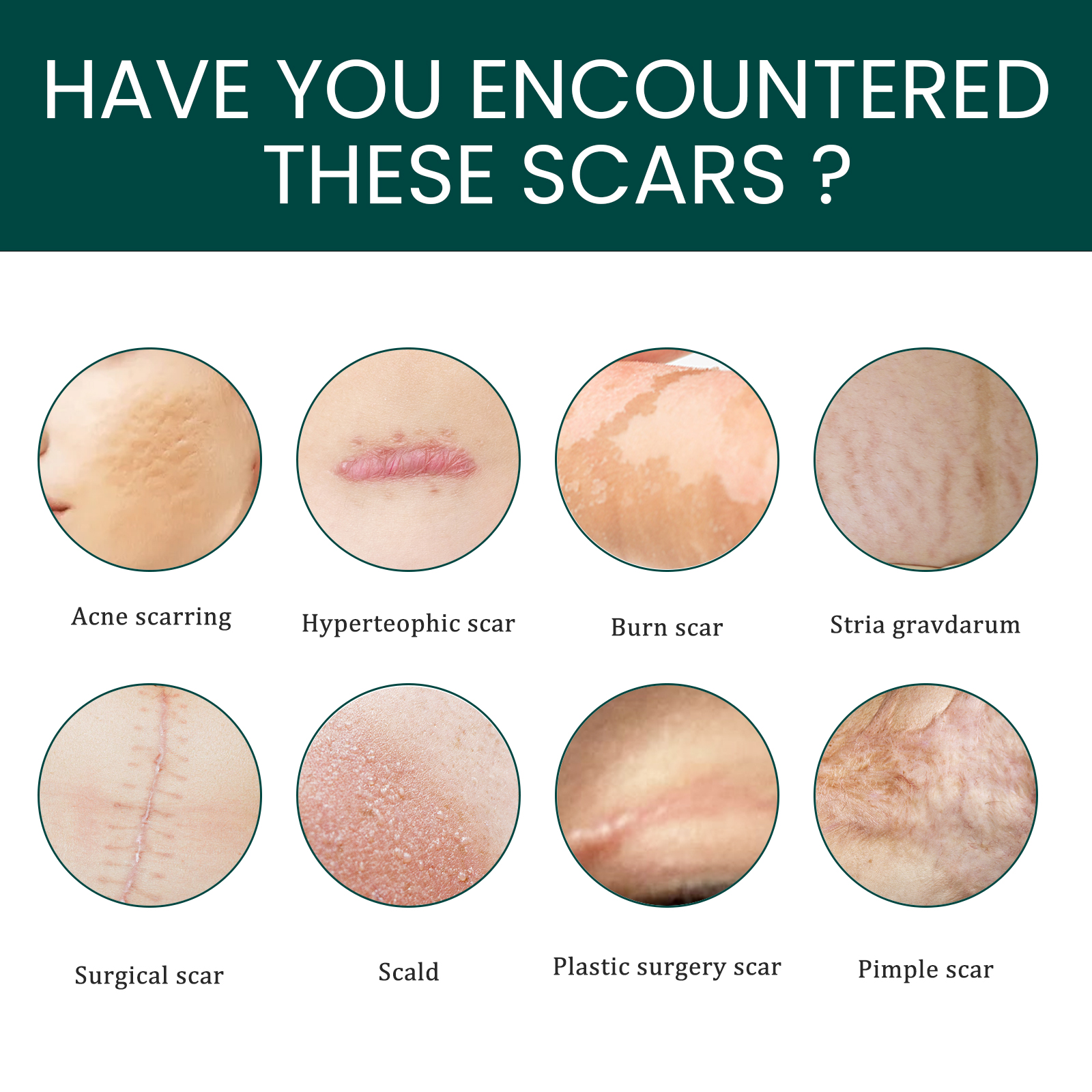 EELHOE Gel Scar Patches for Reducing and Healing Scars Effective Scar ...