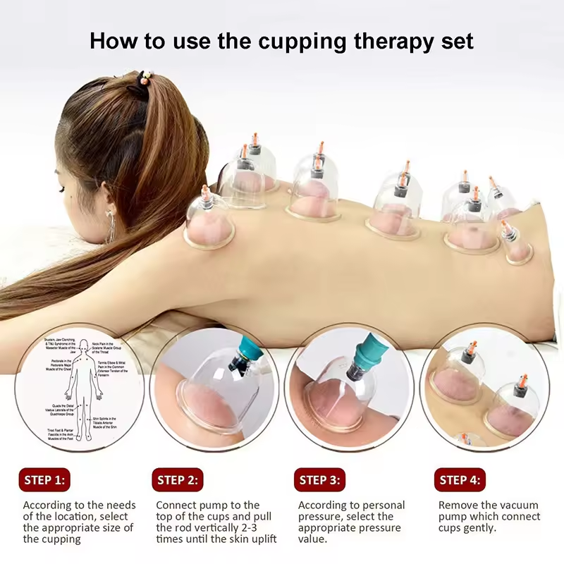 12 Piece Vacuum Suction Cup Cupping Set Pull-Out Suction Cup Massage ...