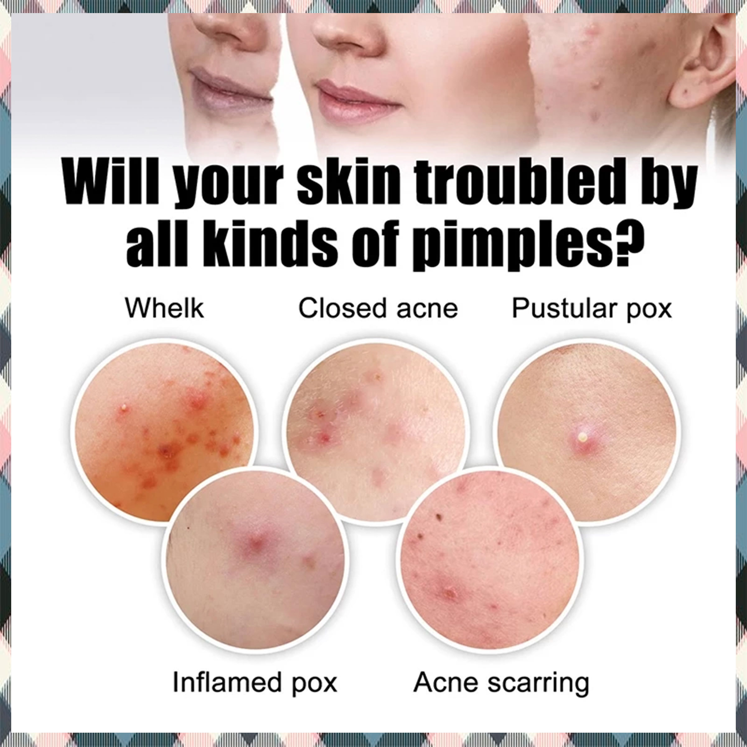 PCTECH_Acne Pimples Patches Hydrocolloid Colorful Suitable All Skin ...