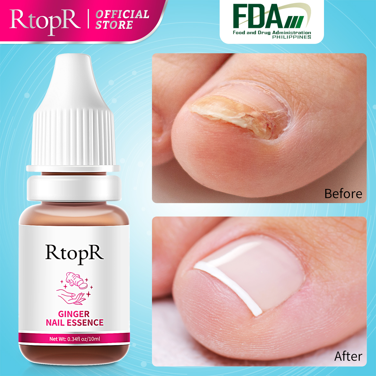 RtopR Ginger Antibacterial Nail Care Essence Strengthens Nails and ...