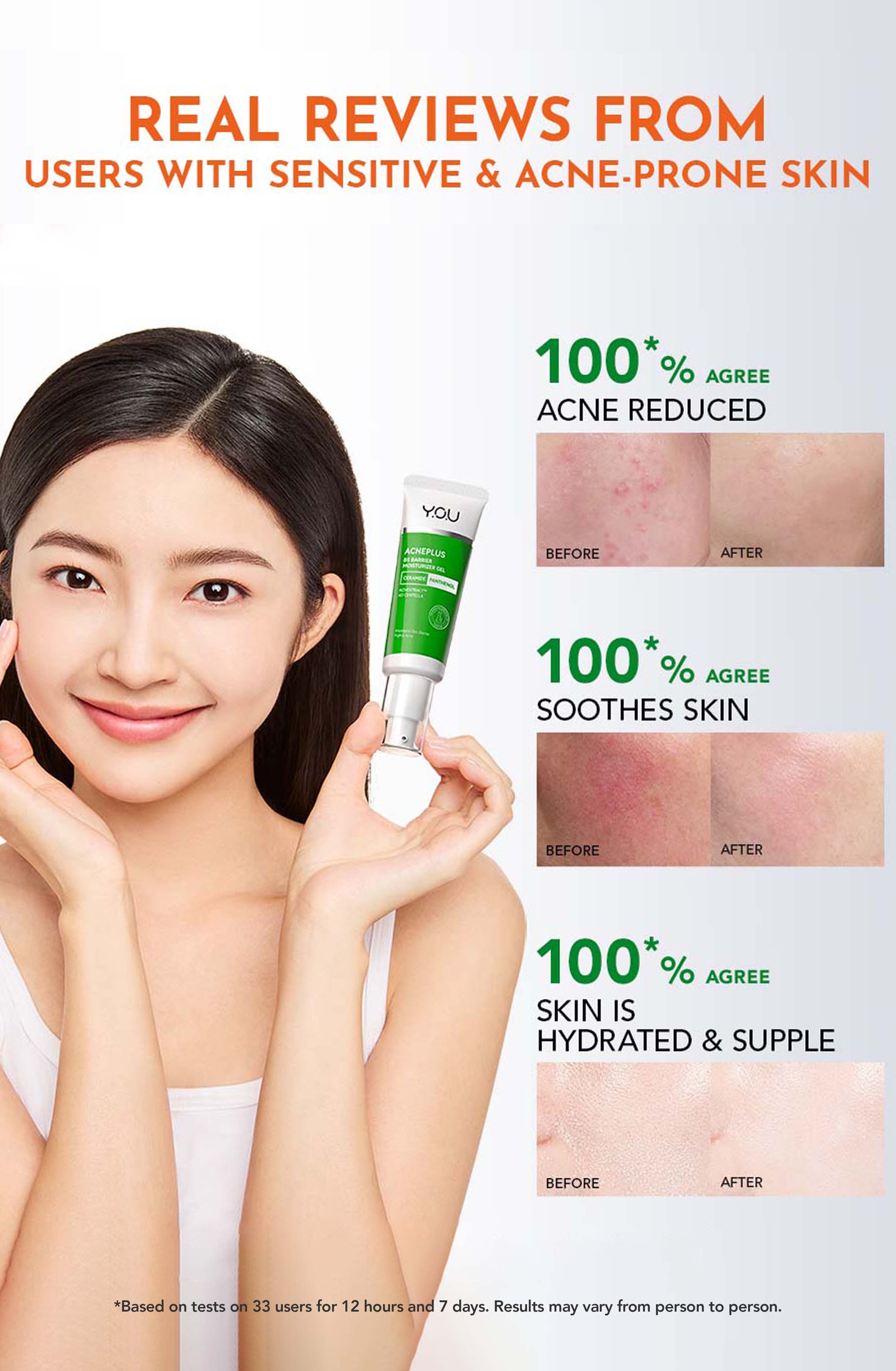 Y.O.U AcnePlus B5 Barrier Moisturizer Gel 30g l Maintains Skin Barrier ...