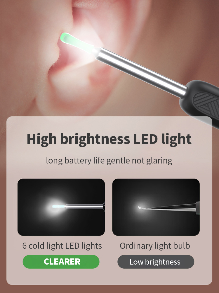 AIODIY Visual Ear Spoon Smart Ultra HD Endoscope Professional Lighted ...