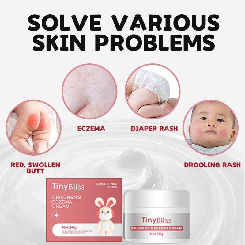TinyBliss Antiseptic Baby Eczema Cream Relief baby acne Nappy Rash ...