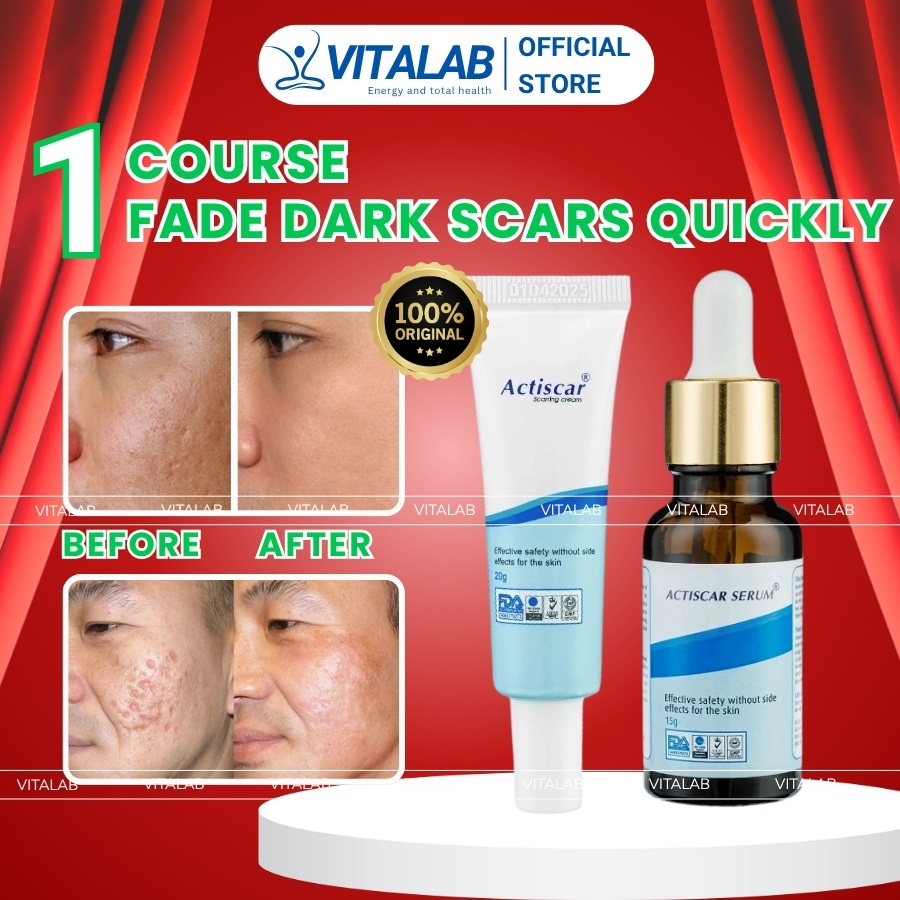 [BEST SELLER] ACTISCAR CREAM 20G - Scar Cream Removal for old scar ...
