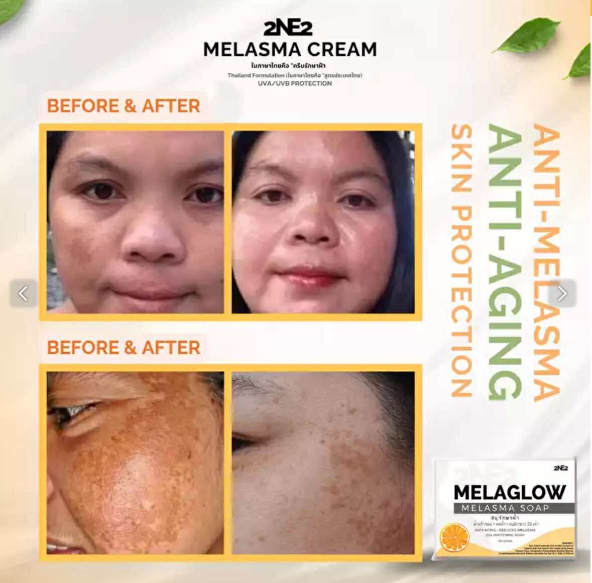 Thailand MelaGlow Melasma Soap w/ Tea Tree Oil (100g) - Melasma, Pekas ...