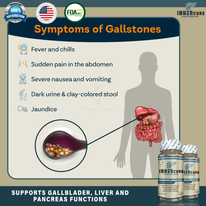 Innercure 100Sofftgels | Removed Gallstones Stone Breaker Bato sa Apdo ...