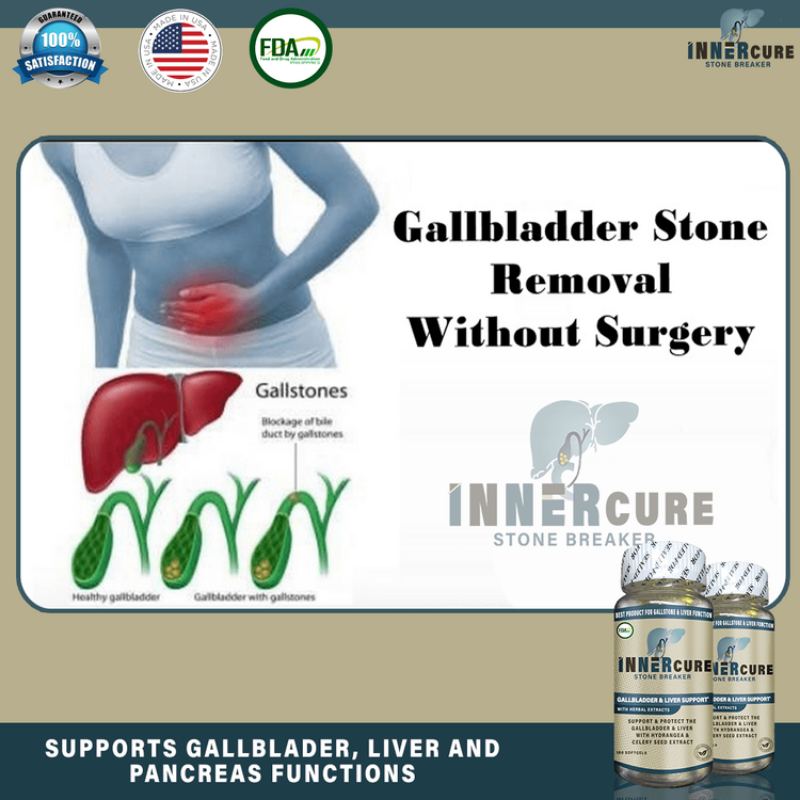 Innercure 100Sofftgels | Removed Gallstones Stone Breaker Bato sa Apdo ...