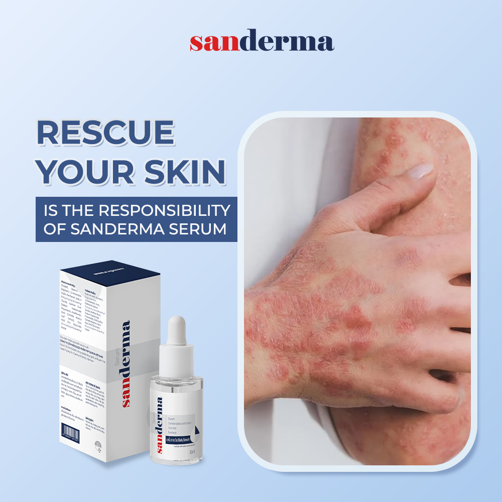 Sanderma Essential Care Combo – Cream + Soap, Soothing Care for Dry ...