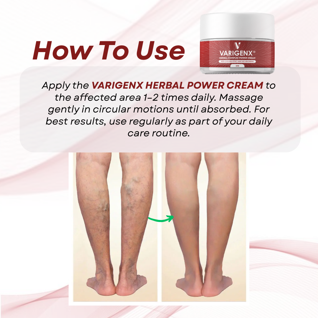 VARIGENX Varicose Veins Remover Cream, Spider Vein Treatment, Reduces ...