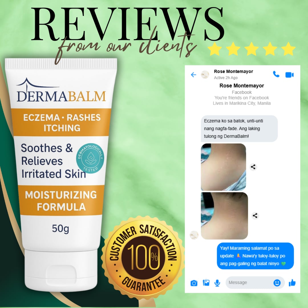 [BUY 2 TAKE 1] DermaBalm ECZEMA / RASHES / ITCHING Cream - 50g Fast ...