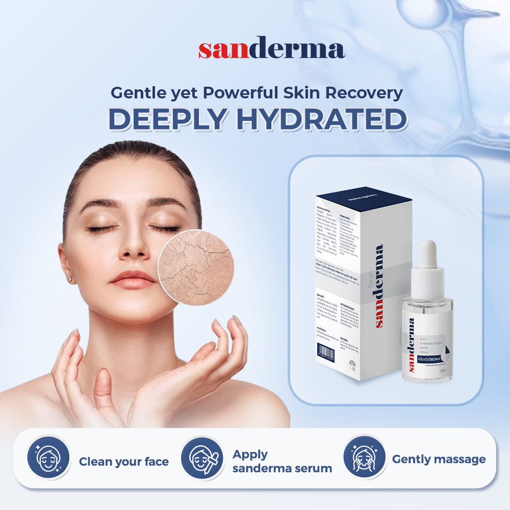 [BUY 3 GET 1 FREE] Sanderma Full Sensitive Skin Combo – Serum + Cream ...