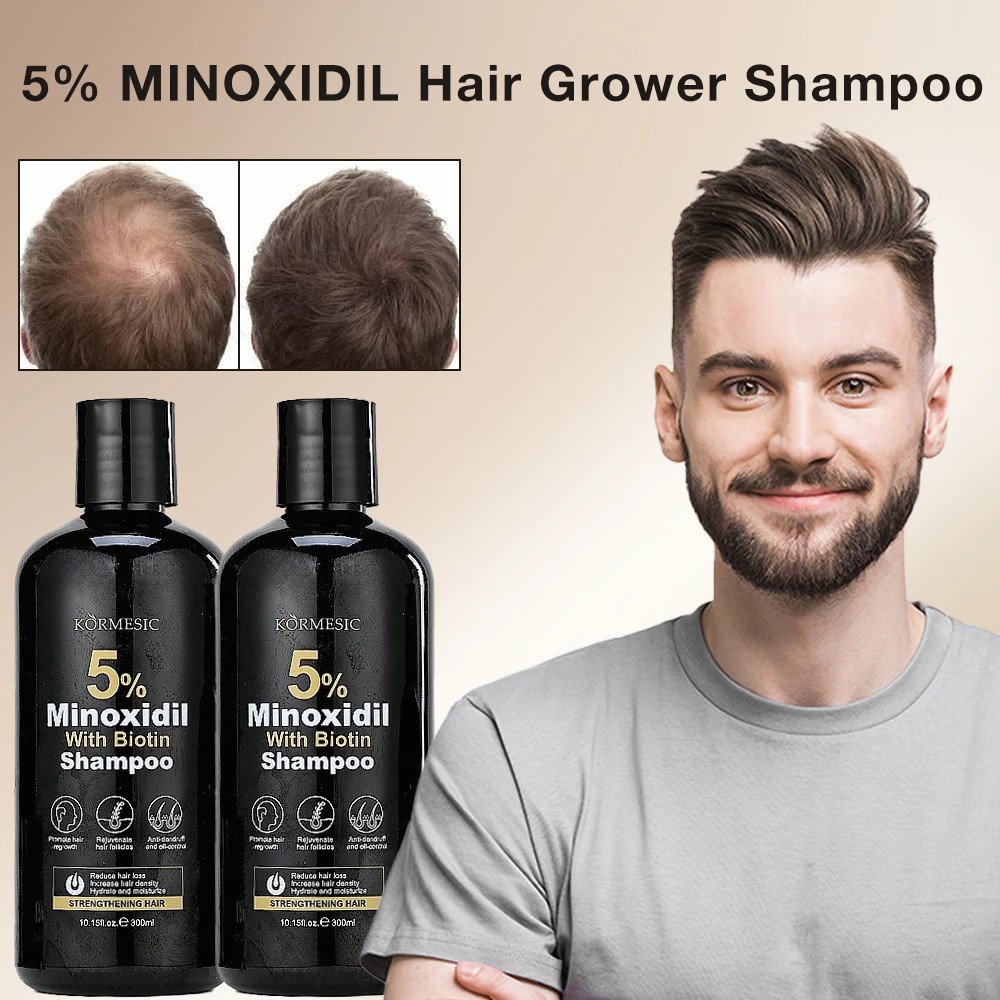HOT! KORMESIC Minoxidil 5% Hair Grower With Biotin Shampoo For Hair ...