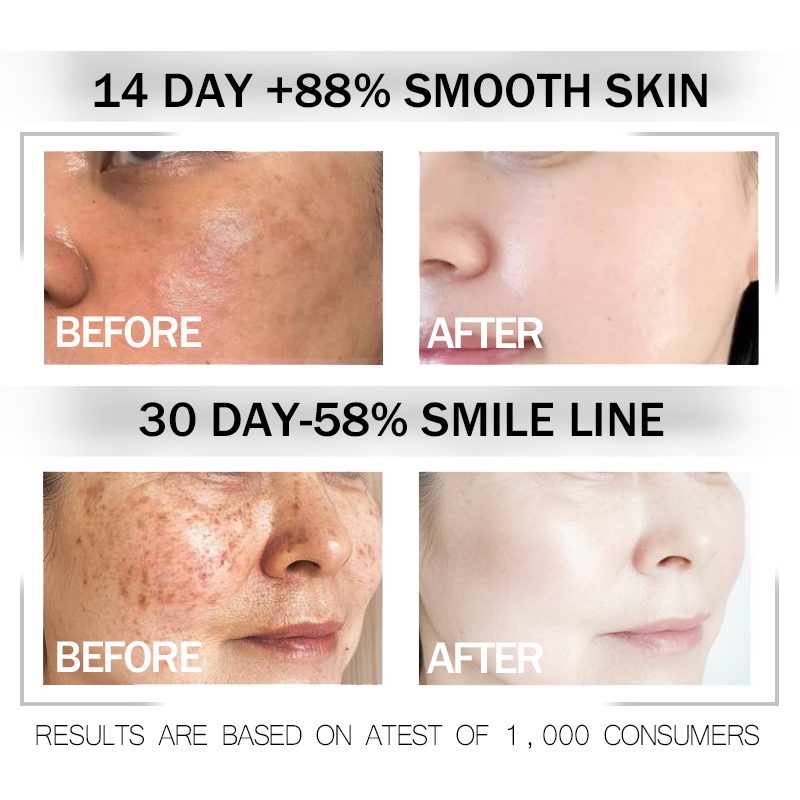 Ordinary Argireline Solution serum 10% 30ml Anti Aging Anti Wrinkle ...
