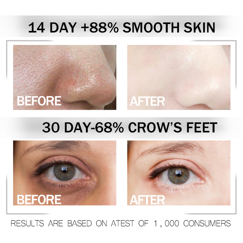 Ordinary Argireline Solution serum 10% 30ml Anti Aging Anti Wrinkle ...