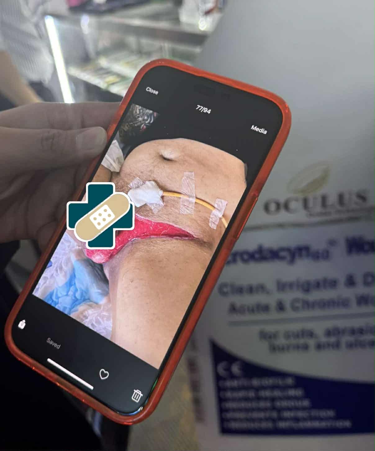 Microdacyn Wound Spray and Hydrogel 60mL&120mL | Shopee Philippines
