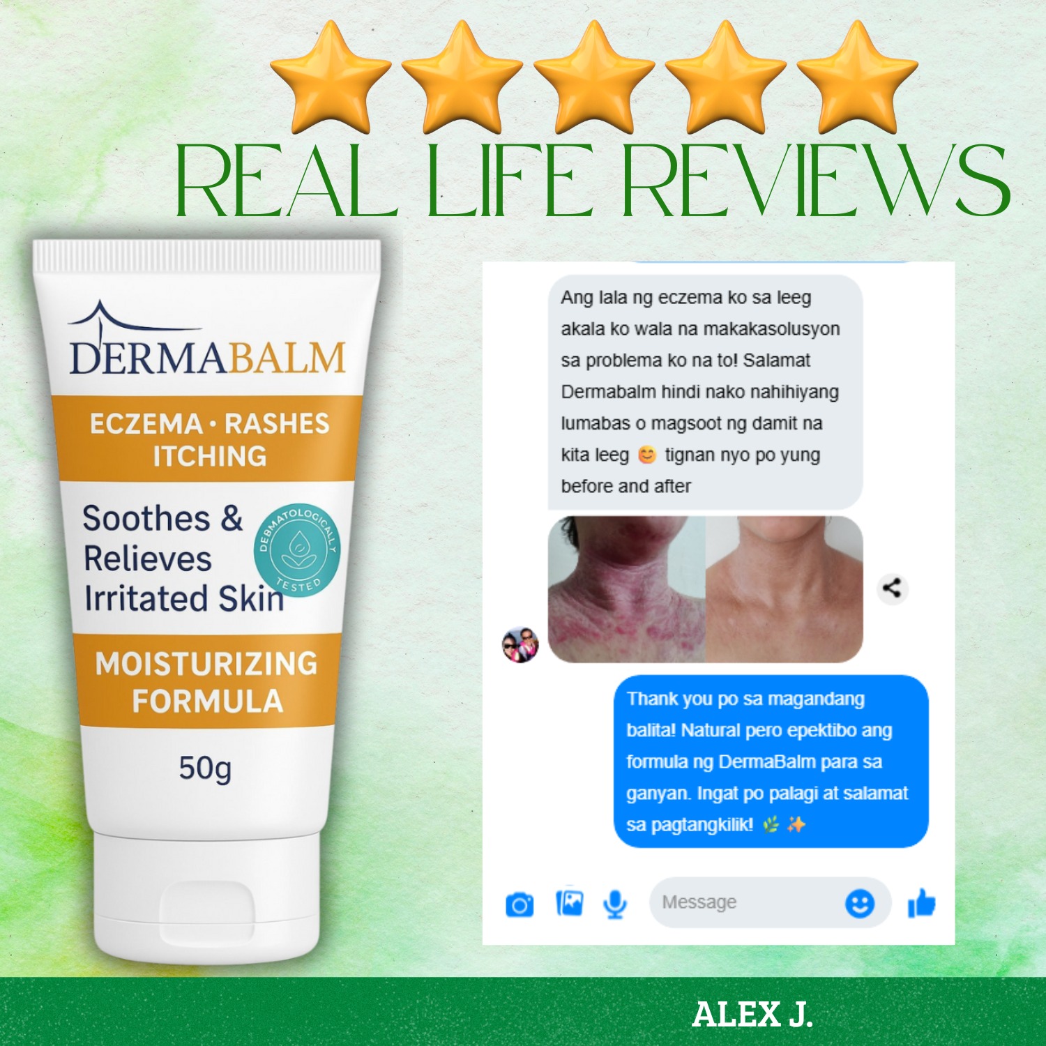[BUY 2 TAKE 1] DermaBalm ECZEMA / RASHES / ITCHING Cream - 50g Fast ...