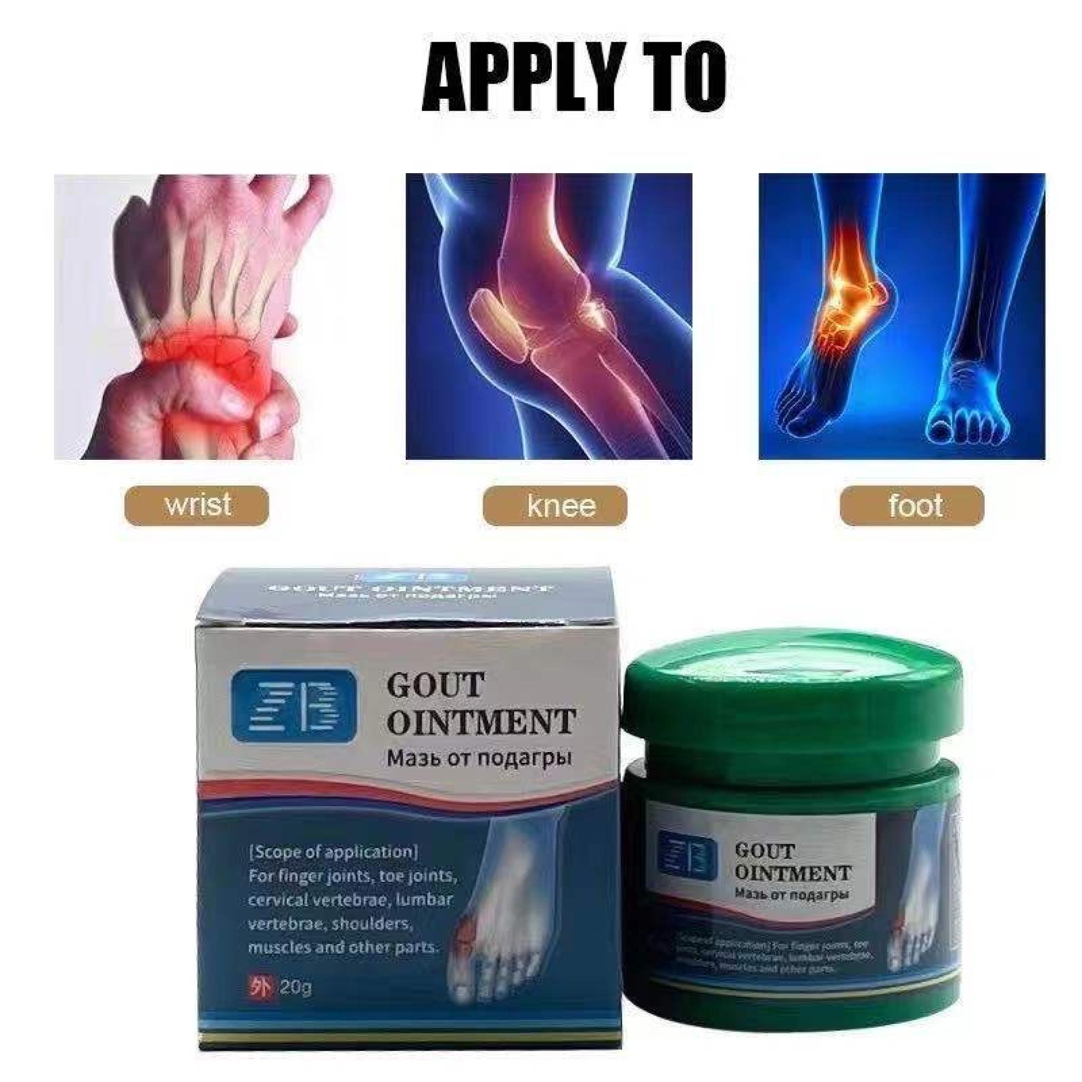 【BUY 1 TAKE 2】GOUT OINTMENT CREAM for Joint Pain Gout Removal Finger ...