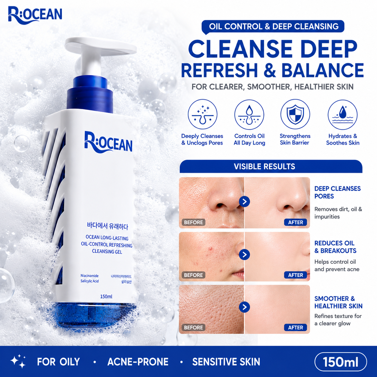 Rocean Salicylic Acid Exfoliating Cleanser 150ml Oil Control Acne ...